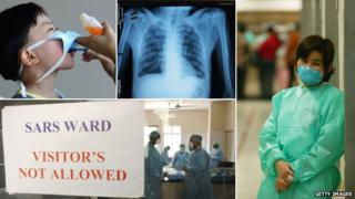 A composite image showing (from left to right): Young boy with a mask on to protect him from Sars, an x-ray of the lungs of someone with Sars, and doctors working to contain the virus
