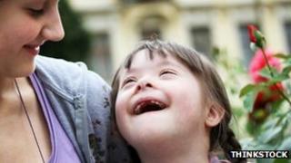 Child with Downs syndrome