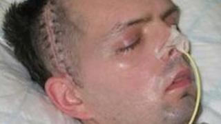 Derry civil servant Paul McCauley after he was beaten up in a sectarian attack in July 2006