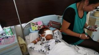 A boy lies on his hospital bed with his eyes covered with bandages as his mother sits next to him at a hospital in Taiyuan, northern China's Shanxi province on 27 August