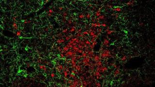 The red neurons are stained serotonin neurons and the green cells are the optogentic probe expressing GABAergic neurons.