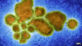 Influenza
