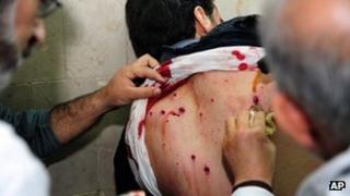 Injured man being treated by doctors