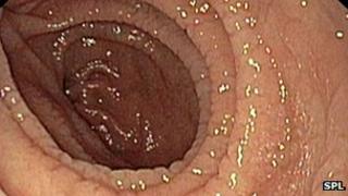 Inside the gut