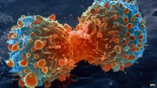 Lung cancer cells