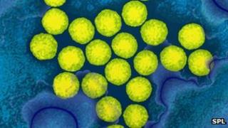 Polio