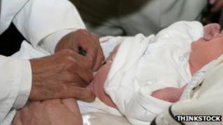 Circumcision on a baby