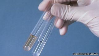 HIV test - yellow means positive, clear negative