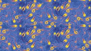 Sperm
