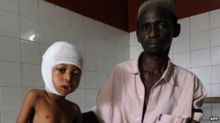 A child sits in a hospital bed with his father in Bangui on 4 December 2013
