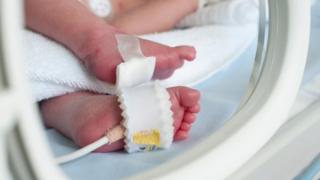 Premature birth