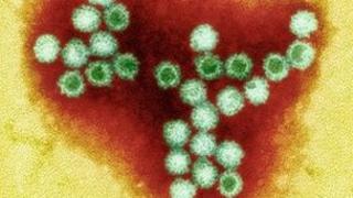 Norovirus particles