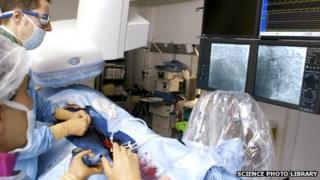 Carrying out an angioplasty