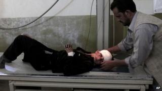 A boy injured in a bombing is treated at Ghanikhel district hospital after two roadside bombs struck the Achin district of Jalalabad, east of Kabul, Afghanistan, on 28 November 2013