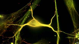 Neurons in hippocampus