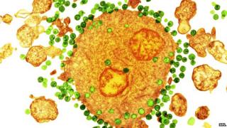HIV