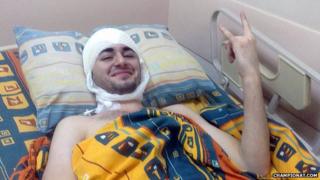 Grigory Simonyan on a hospital bed