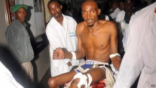 Wounded man arrives at hospital in Mombasa (3 May 2014)