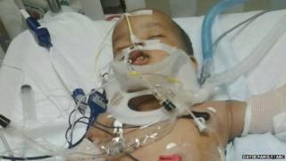 Musa Dayib in hospital