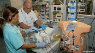 Doctors using the dialysis machine for babies, called CARPEDIEM
