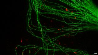 tubulin and lysosomes