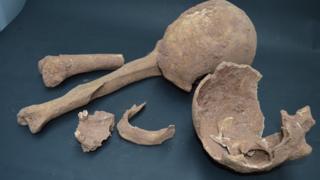 Fragments of the skulls and bones