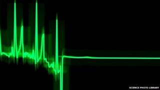 Monitor trace
