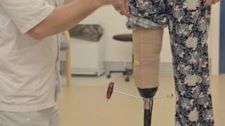 Woman getting fitted with a prosthetic leg, her trouser is rolled up and the prosthetist is using a screwdriver to tighten screws on the prosthetic