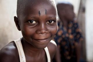 Ten-year-old Luc after scarification