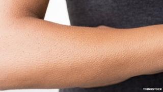 Goose bumps