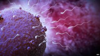 Sperm