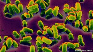 Clusters of the bacteria that cause bubonic plague