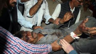 A bus accident victim at a hospital in Shimla on 30 July 2014