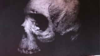 Skull