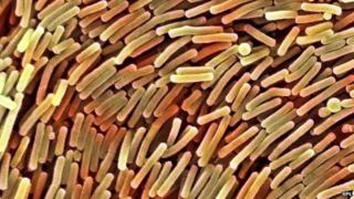 Bacteria