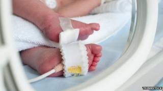 Premature birth