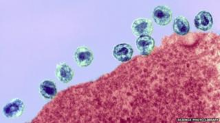 Coloured transmission electron micrograph (TEM) of HIV particles (small, round) on the membrane of a host CD4+ lymphocyte white blood cell (red).