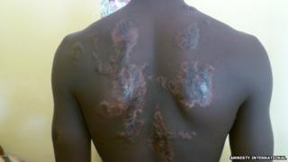 A boy who was 15 years old when he was arrested and detained in Damaturu, Yobe state, for being a suspected Boko Haram member