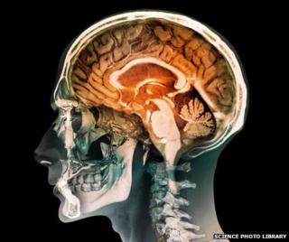 Human brain