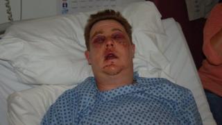 Man in hospital bed