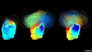 Illustration of nerve networks in the brain