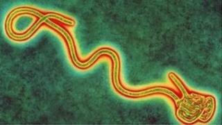 Coloured transmission electron micro graph of a single Ebola virus, the cause of Ebola fever