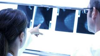Breast x-ray