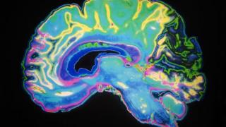brain
