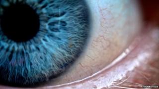 Eye