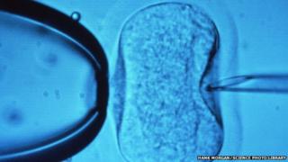 A needle injects a sperm cell directly into a human egg in IVF