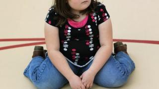overweight child