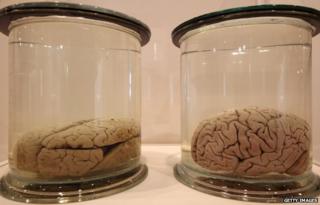 Preserved brains seen in London, England, on 27 March 2012