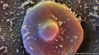 Malaria-infected red blood cell