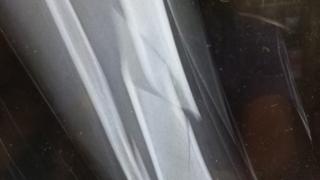 Paul Dallimore's x-ray